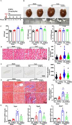 Empagliflozin improves pressure-overload-induced cardiac hypertrophy by inhibiting the canonical Wnt/β-catenin signaling pathway